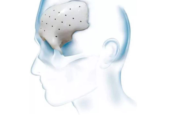 午夜电影网站机会对PEEK材料起到怎样的作用？-午夜精品久久久